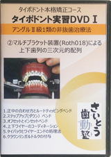第2巻　アングルⅡ級1類の非抜歯治療法（2）マルチブラケット装置（Roth018）による上下歯列の三次的配列