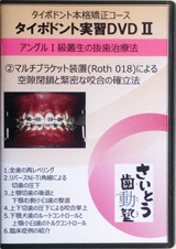 第4巻　アングルⅠ級叢生の抜歯治療法（2）マルチブラケット装置（Roth018）による空隙閉鎖と緊密な咬合の確立法