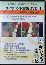 第4巻　Palatal anchor plate(PAP)と特殊なTADs